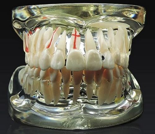 Tipodonto demostracion tratamientos dentales DJL